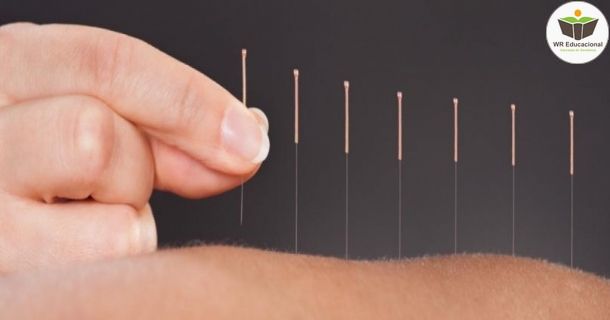 introdução a acupuntura