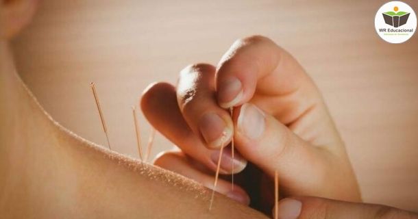 técnicas de acupuntura